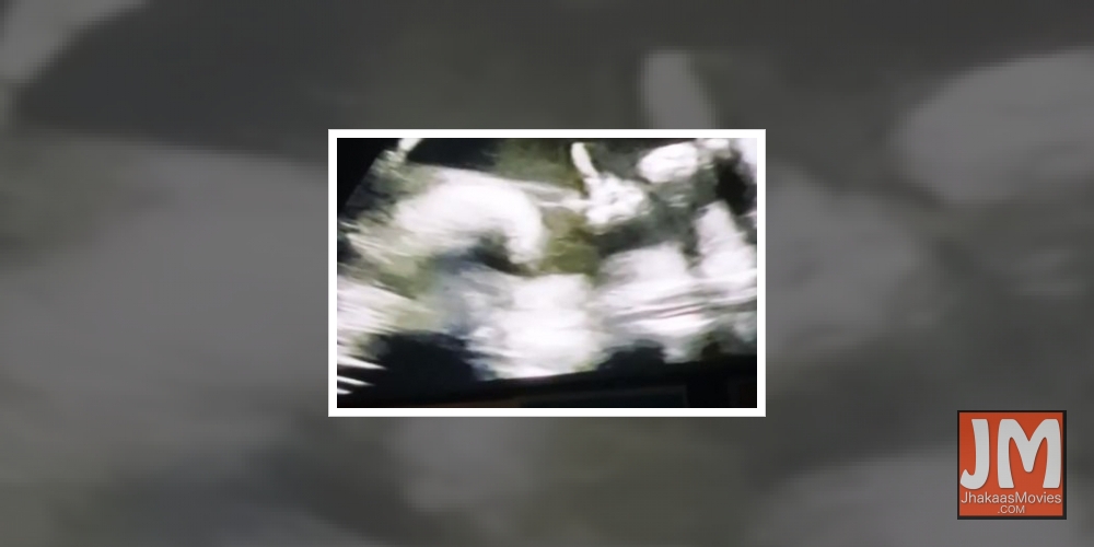 Did Katy Perry's unborn daughter just give her the finger?.