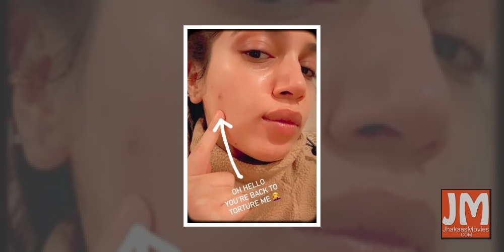 Actress Bhumi Pednekar took to social media on Thursday, to lay bare her pimple woes for fans.