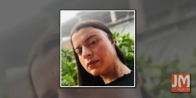 Rangoli Chandel recalls her acid attack ordeal