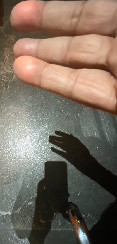 Big B recalls the time a Diwali bomb exploded in his hand.