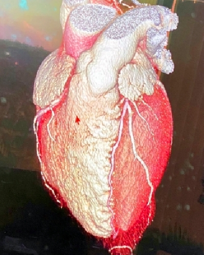Bollywood heartthrob Hrithik Roshan has shared the shape of his heart! Hrithik, popularly called the Greek God of Hindi films took to Instagram to share a picture of a human heart. He captioned it: 